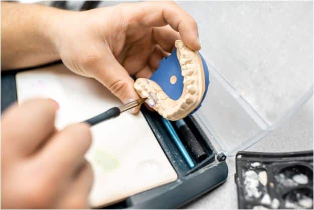 Dental Restorations