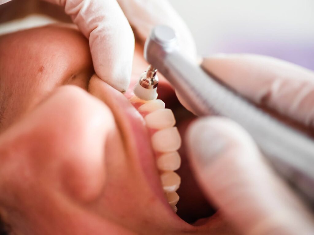 periodontal disease